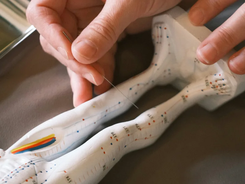 Acupuncture at Mountain Creek Chiropractic in Red Bank