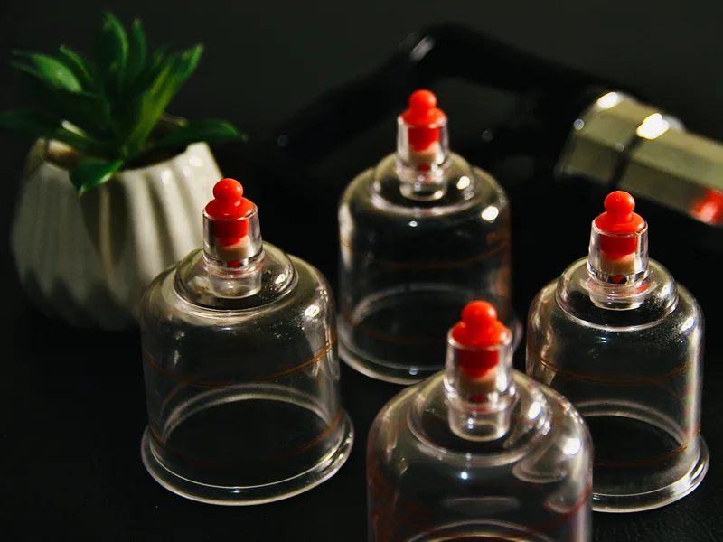 How Cupping Therapy works at Mountain Creek Chiropractic