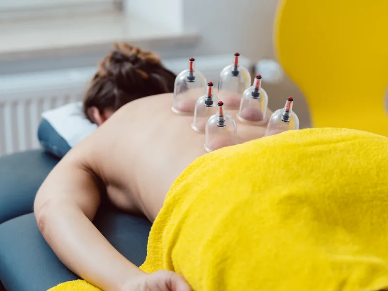 Cupping Therapy at Mountain Creek Chiropractic in Red Bank