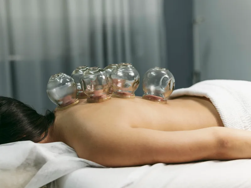 Cupping Therapy at Mountain Creek Chiropractic in Red Bank