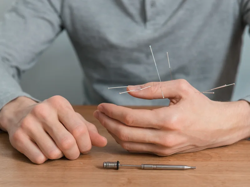 Dry Needling at Mountain Creek Chiropractic in Red Bank