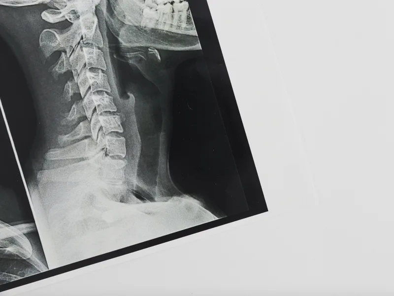 X-Rays at Mountain Creek Chiropractic in Red Bank